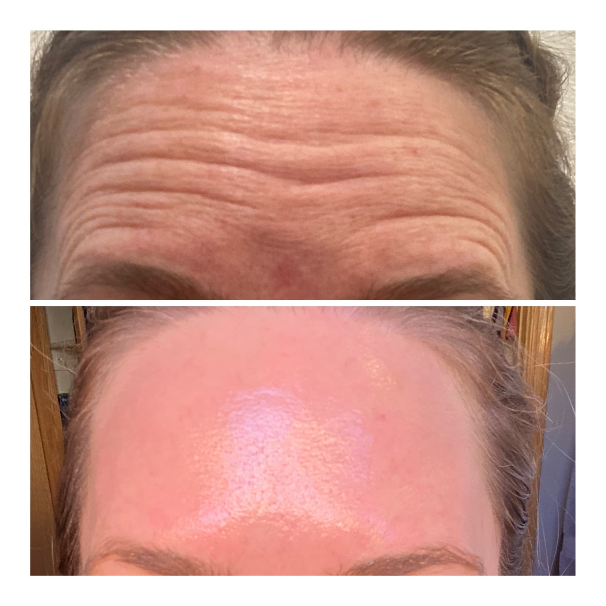 Innovation skin care