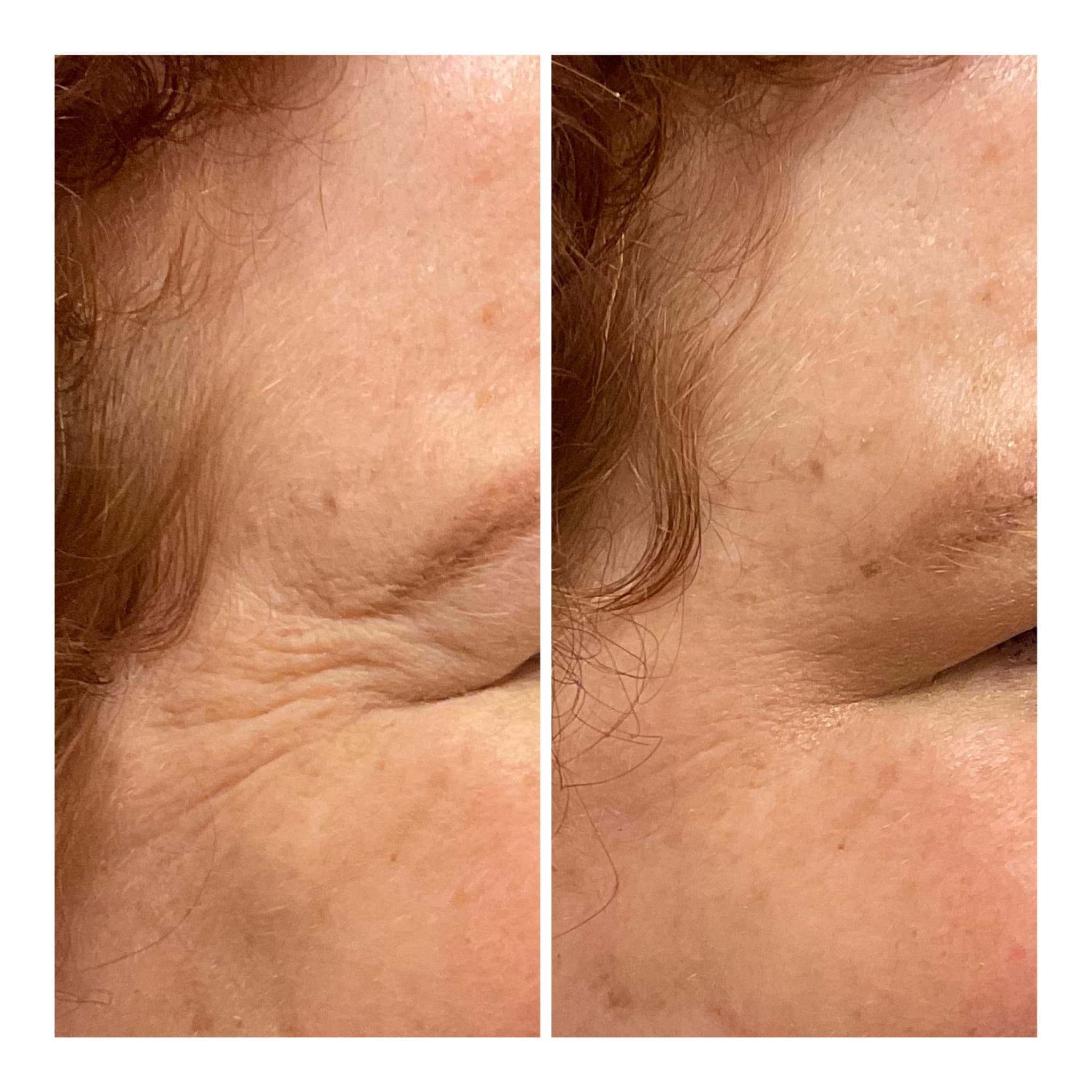 Innovation skin care photo 5