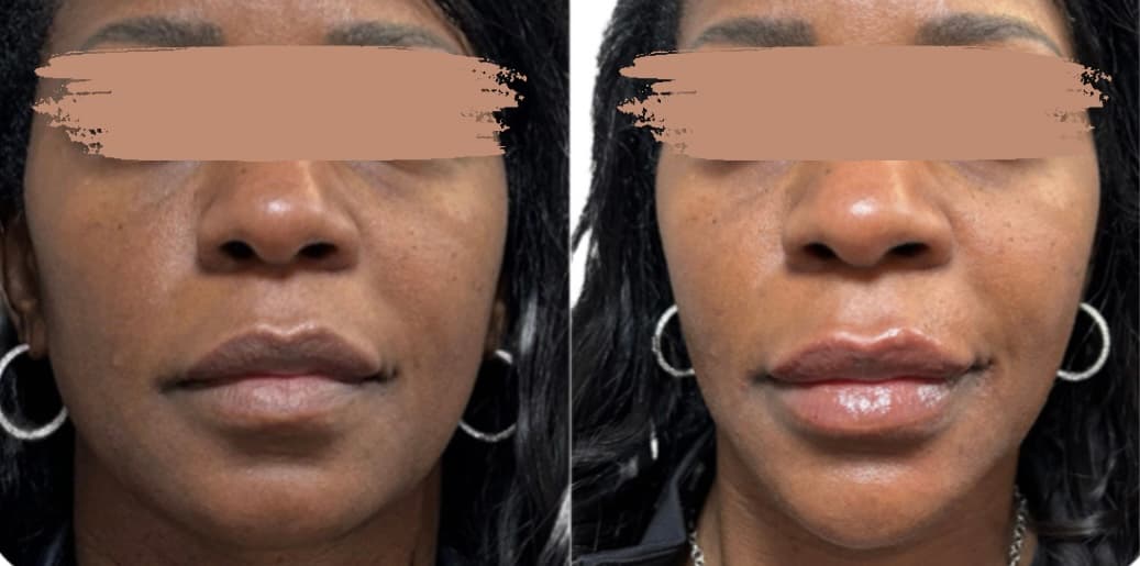 Dermacenter Medical Spa photo 5