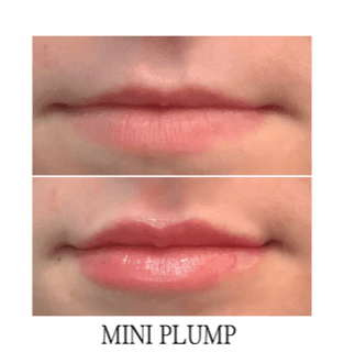 Dermacenter Medical Spa photo 7