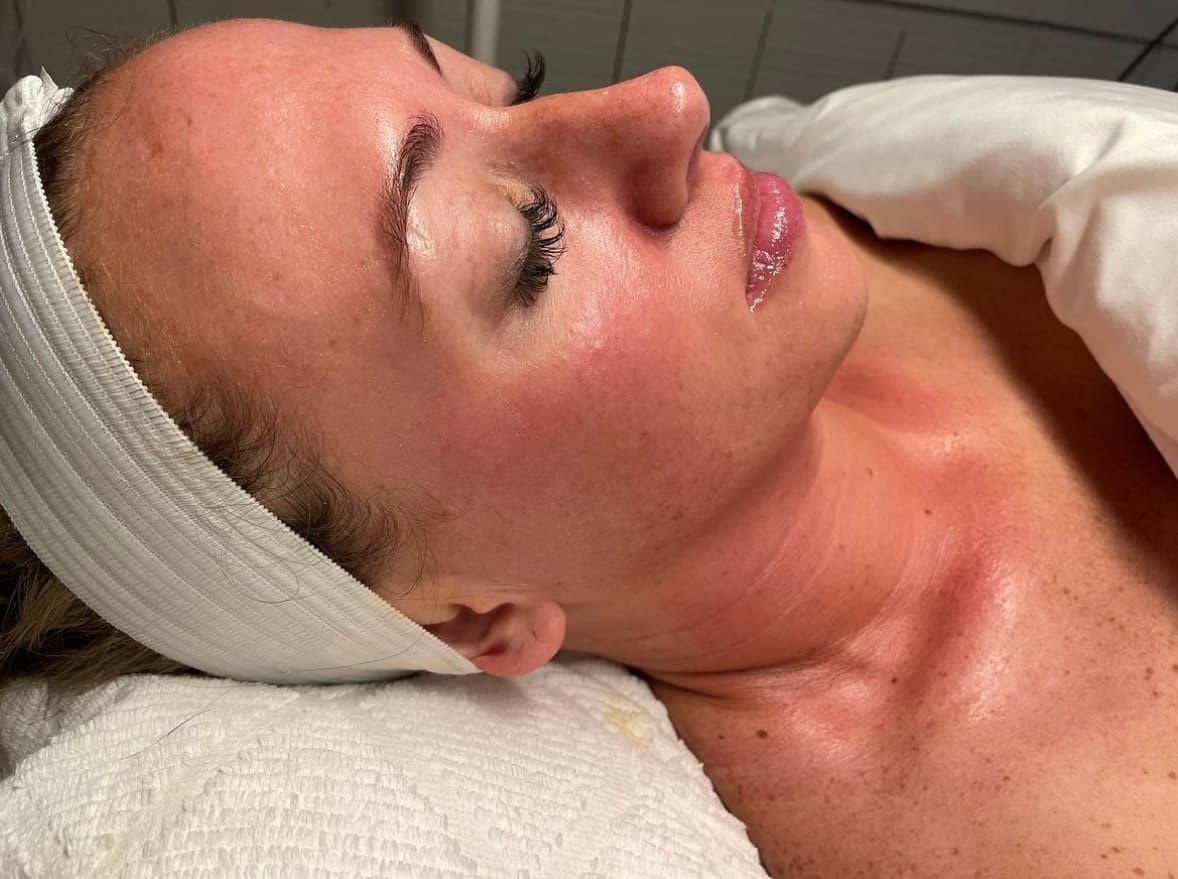 Palmetto Facial Aesthetics photo 6