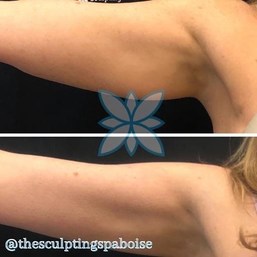 The Sculpting Spa Boise photo 8
