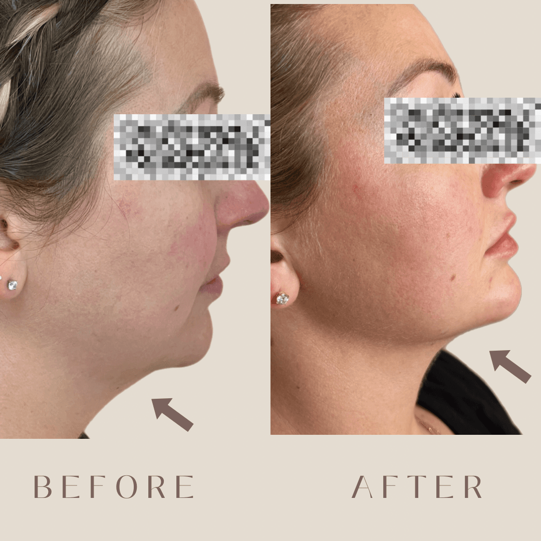 The Lipo Method photo 2