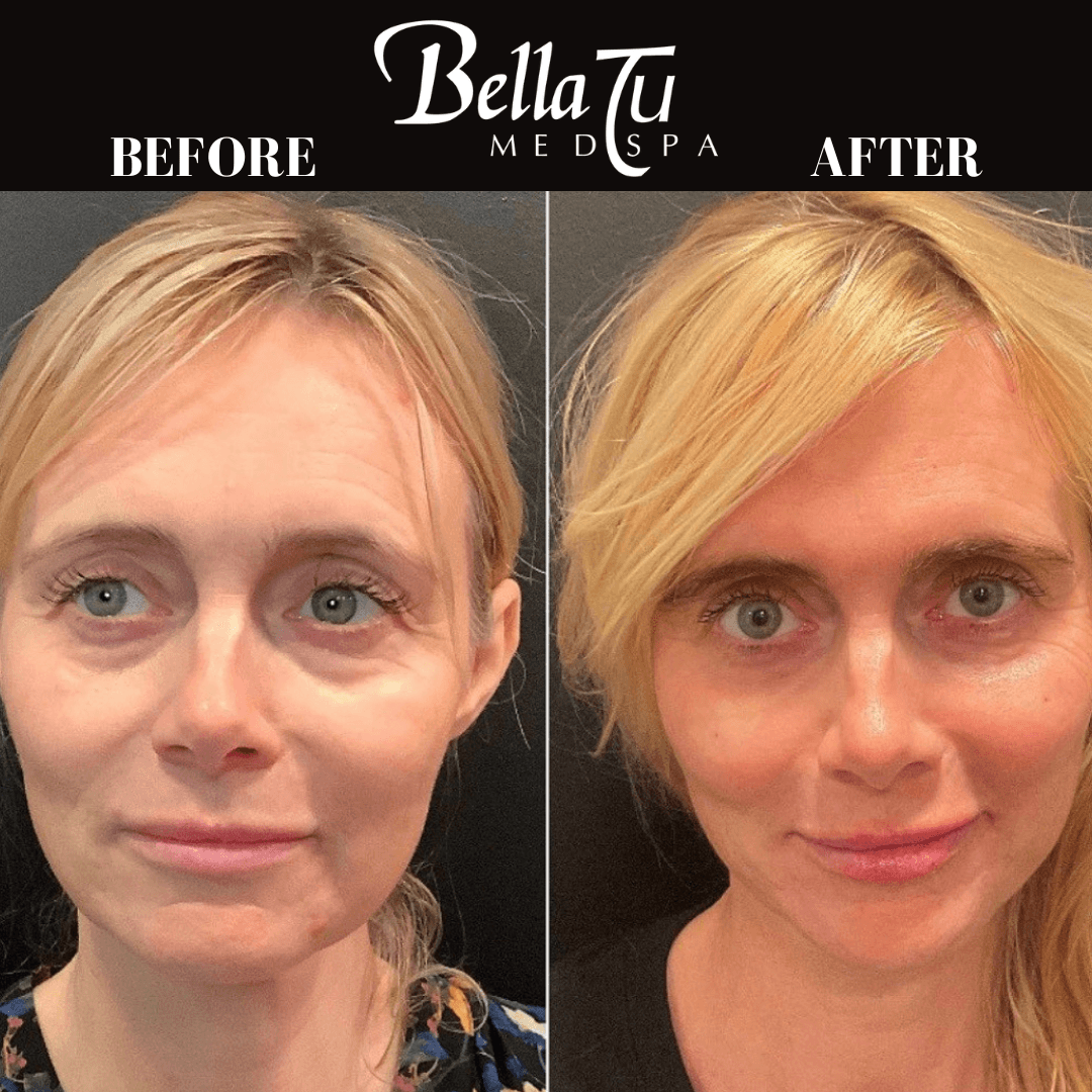 Bella Tu Med Spa photo 9
