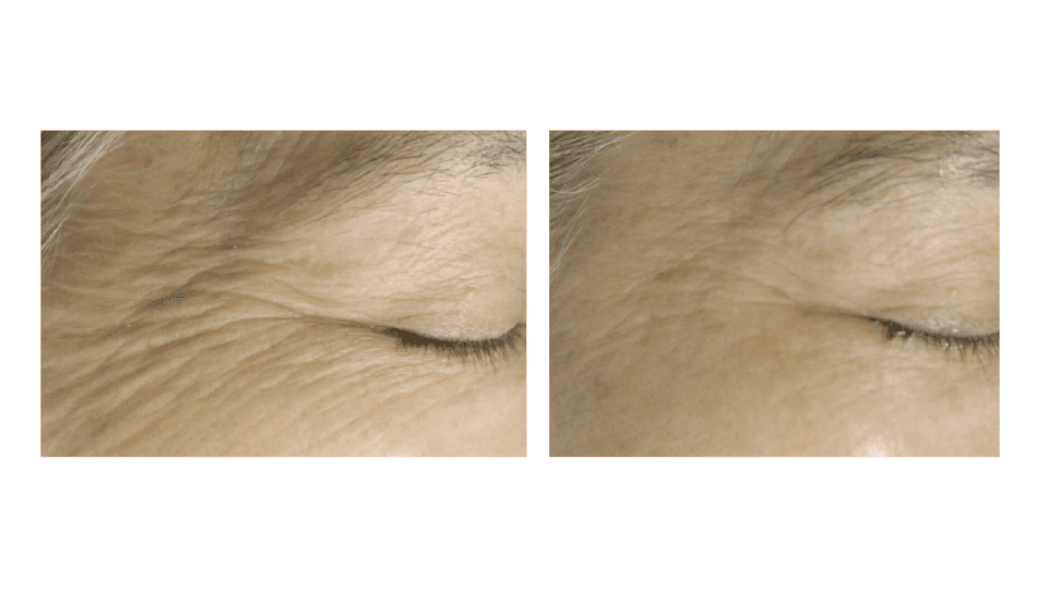 Bright Esthetics & Body Wellness photo 11