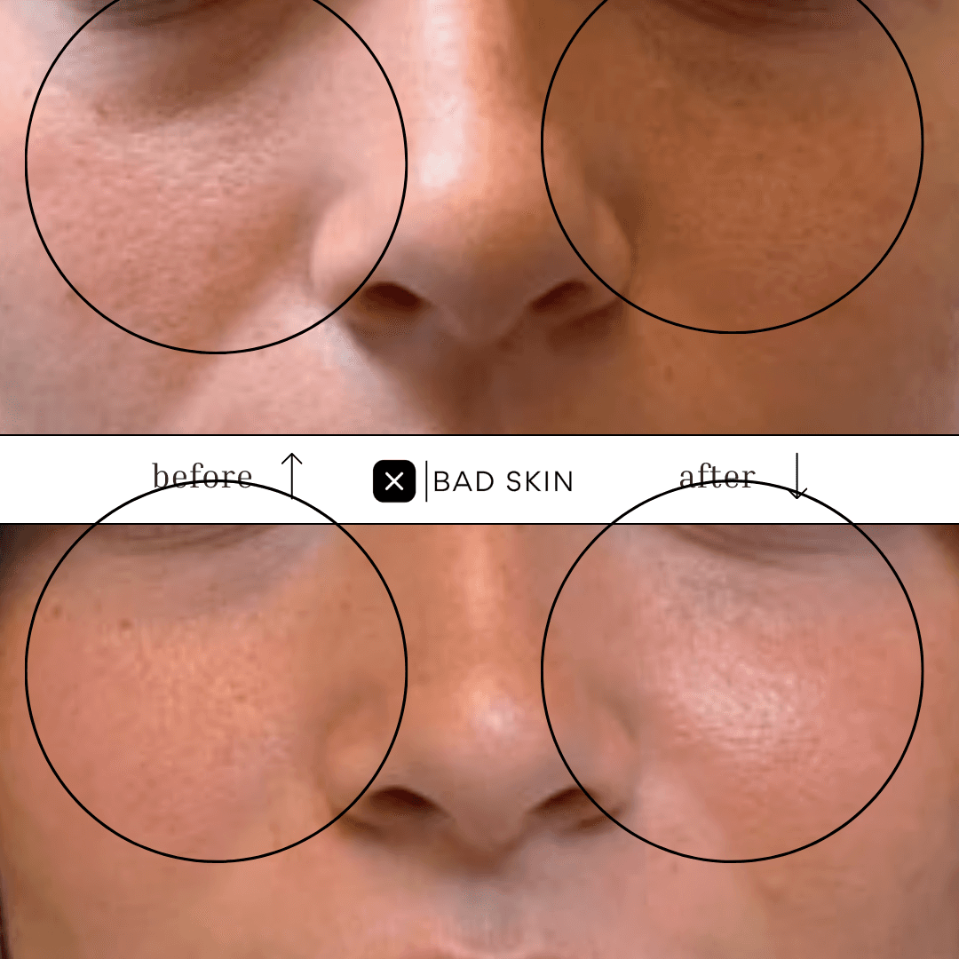 Bad Skin photo 6