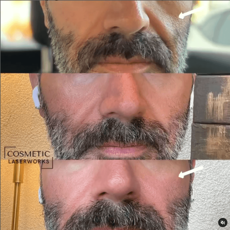 Beverly Hills Aesthetic Medics photo 10