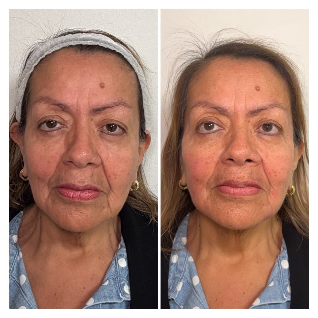 Rejuvenate Aesthetics & Wellness, LLC photo 1 of 8