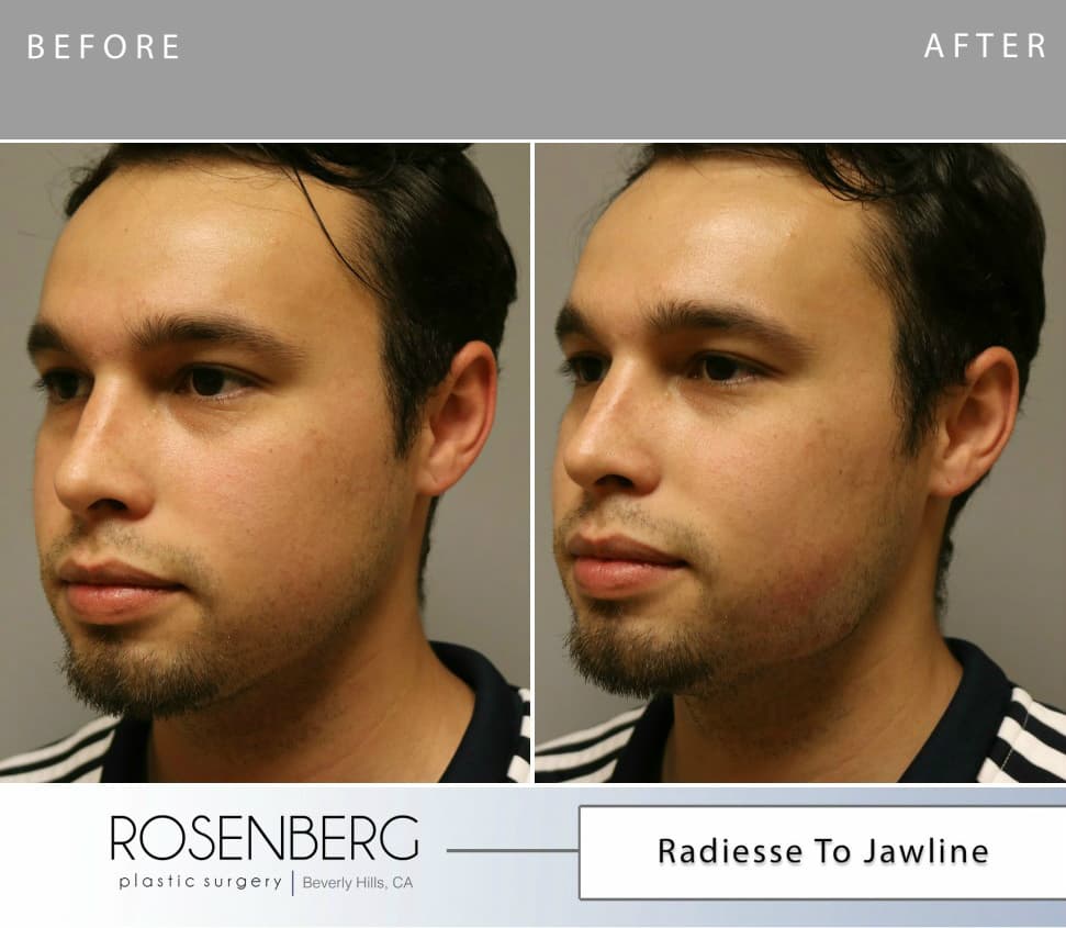 Rosenberg Plastic Surgery