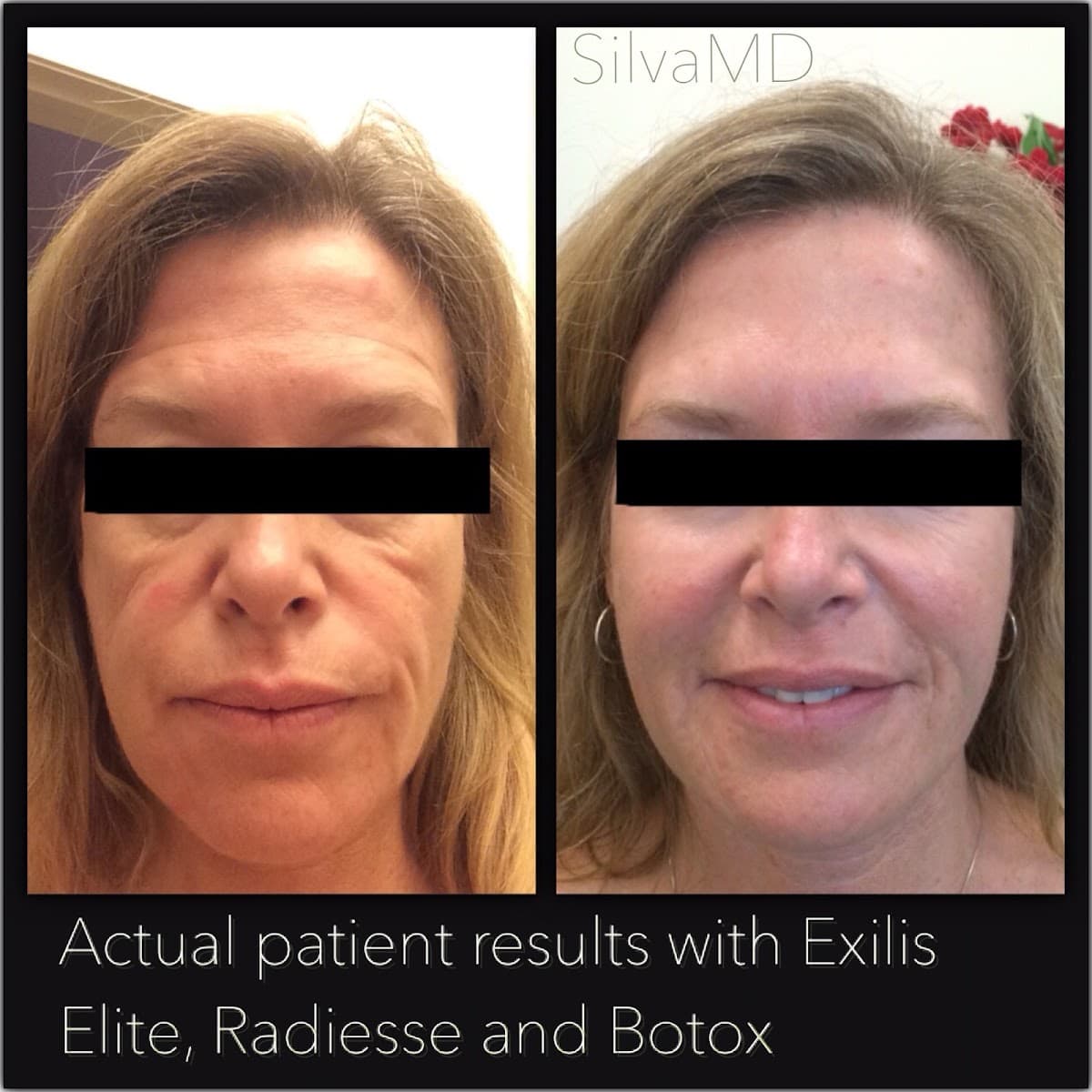 Melinda Silva, MD Anti-Aging & Wellness