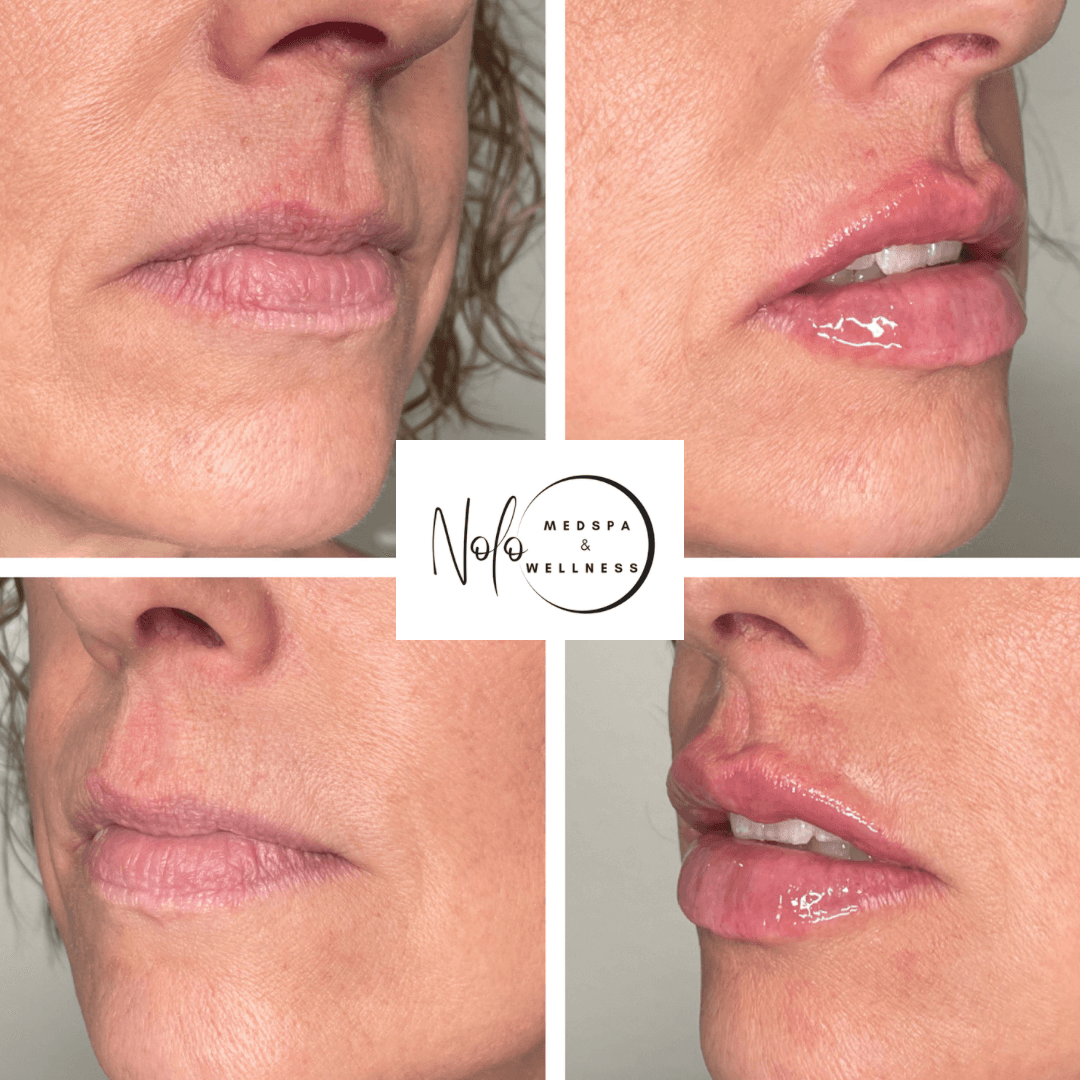 Nolo Medspa & Wellness
