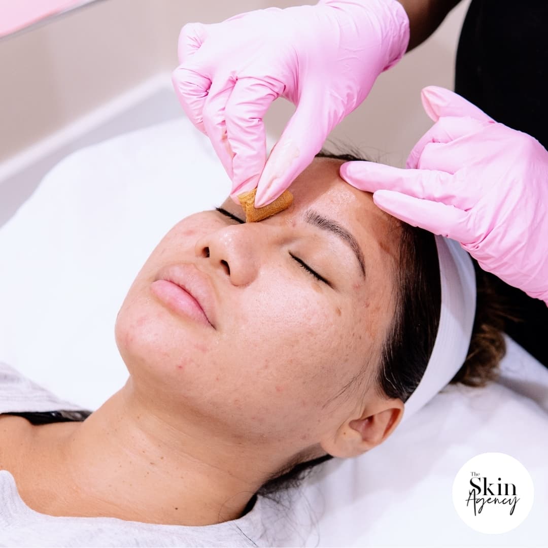The Skin Agency