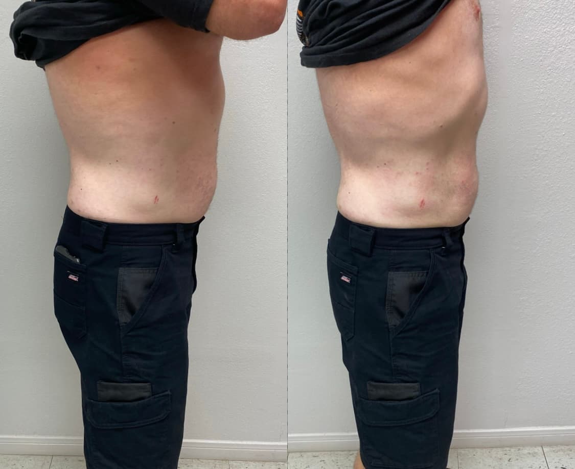 Curve Body Contouring and More photo 1 of 8