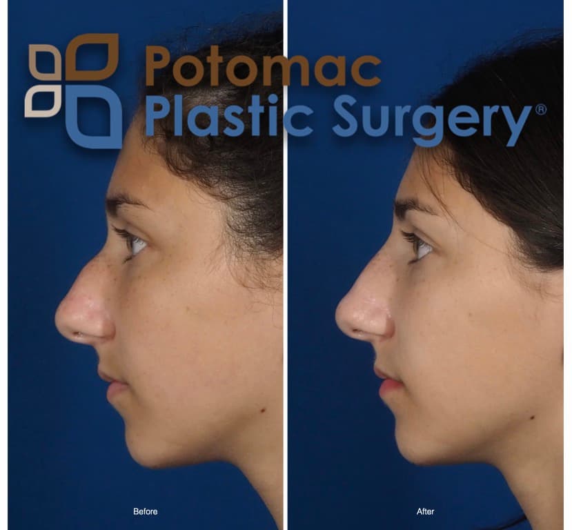 Potomac Plastic Surgery: Houtan Chaboki, MD