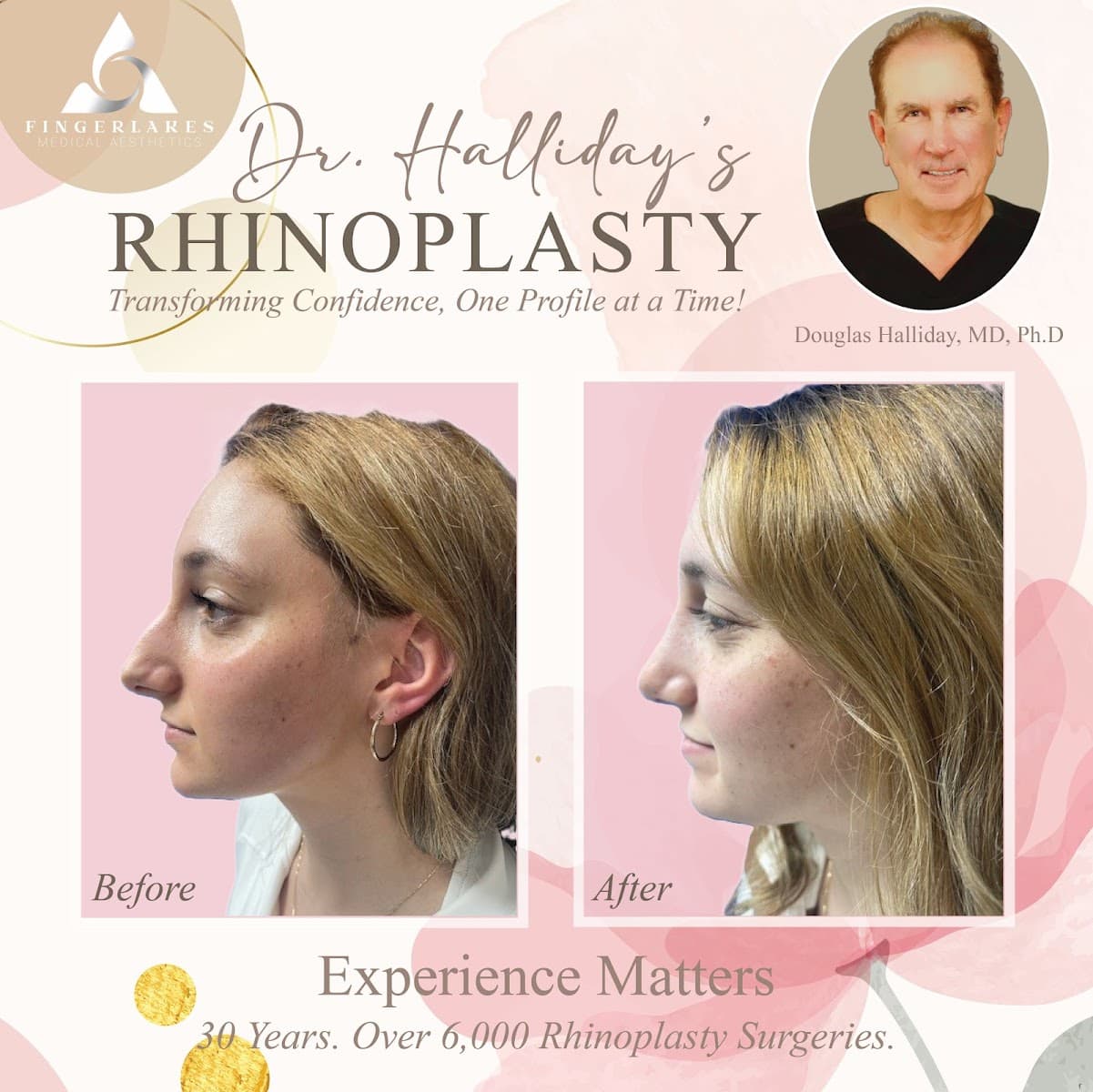 Finger Lakes ENT, Aesthetics, Skin Oncology Cicero NY