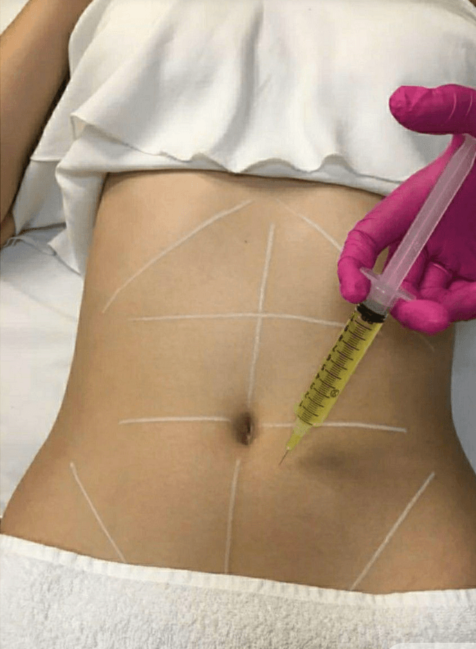 KarenMartinezMedspa photo 1 of 6