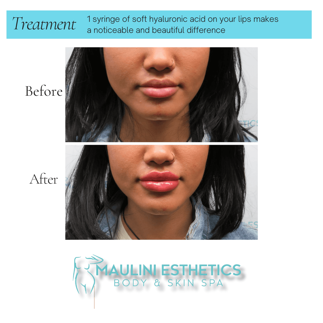 Maulini Esthetics Body & Skin Spa