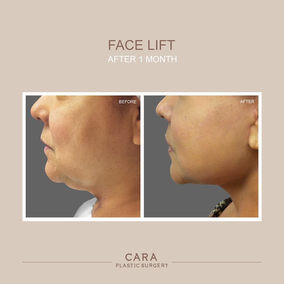 CARA Plastic Surgery photo 1 of 8