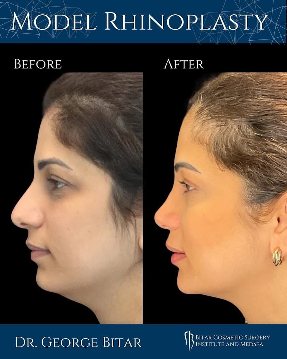 Bitar Cosmetic Surgery Institute & Medspa