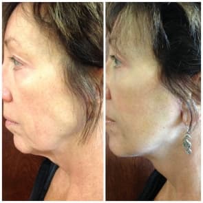 Tate MediSpa