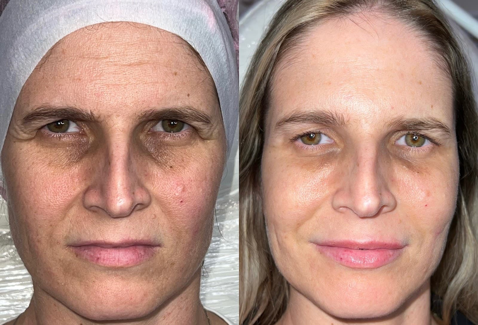 Sheyla MedSpa
