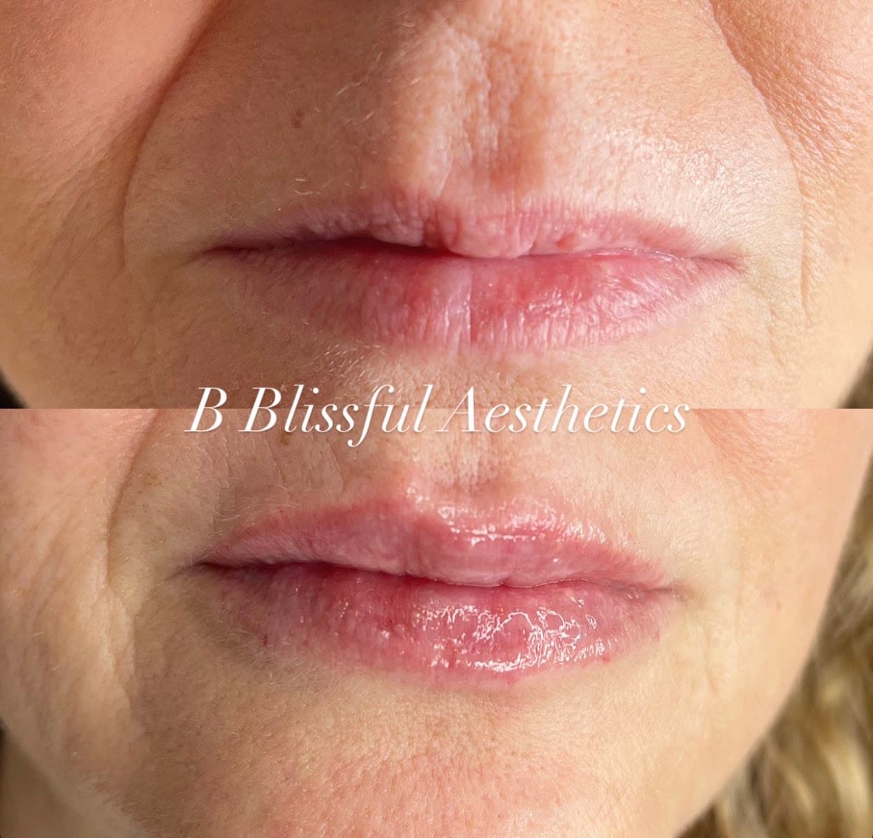 B Blissful Aesthetics photo 1 of 8