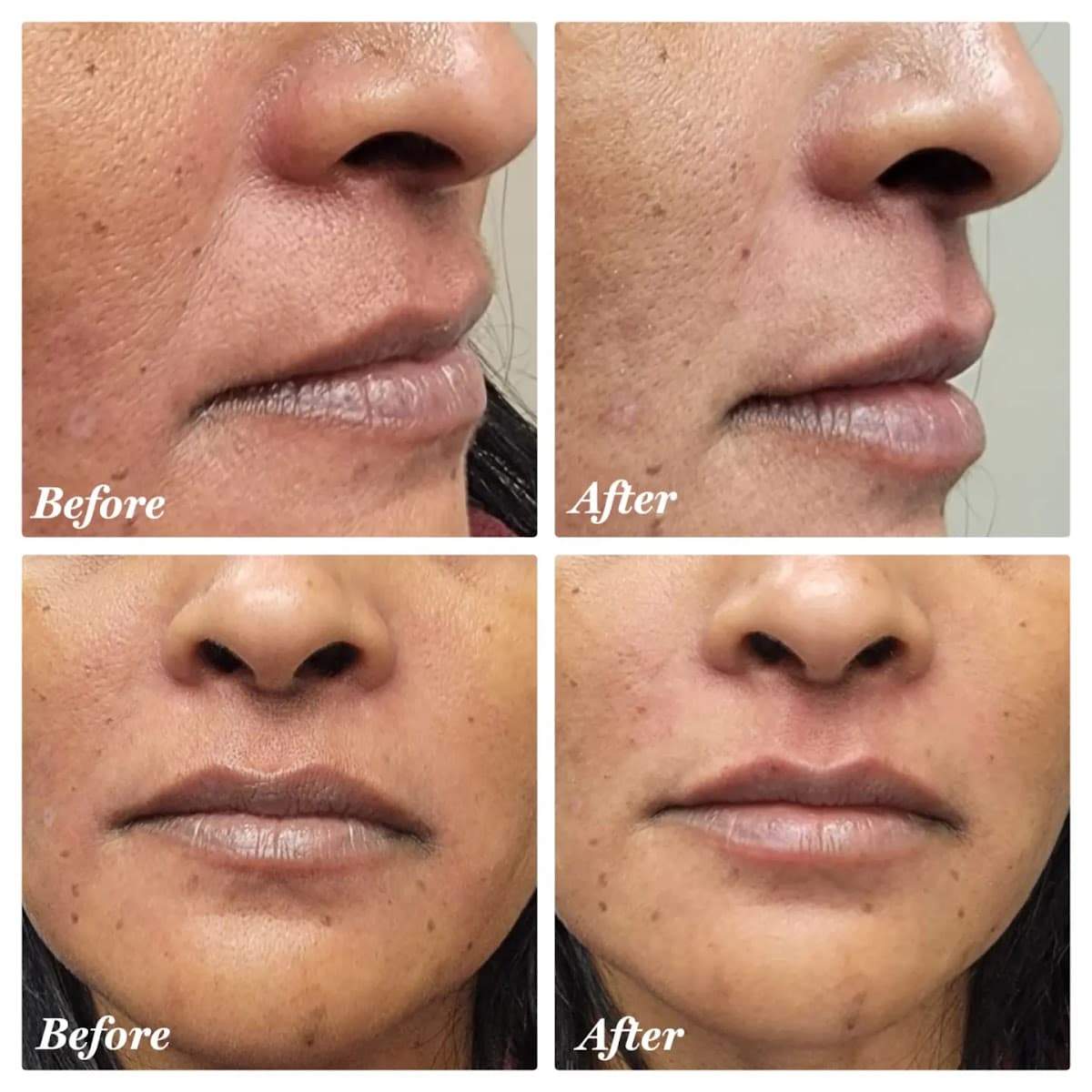 Royal MedSpa