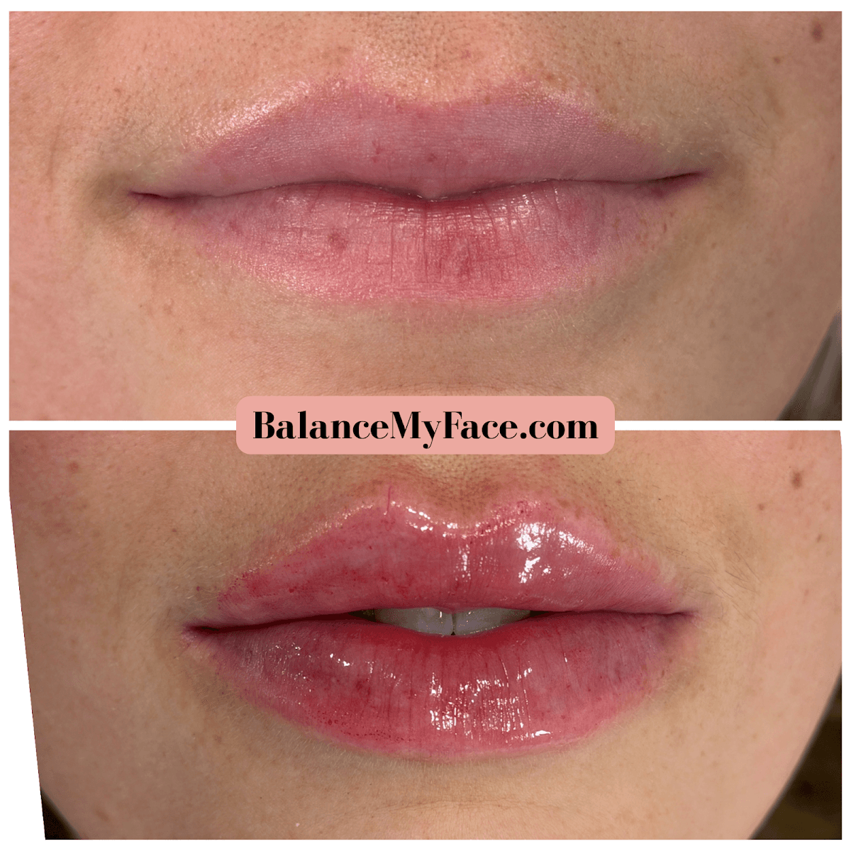 Balance Facial Aesthetics