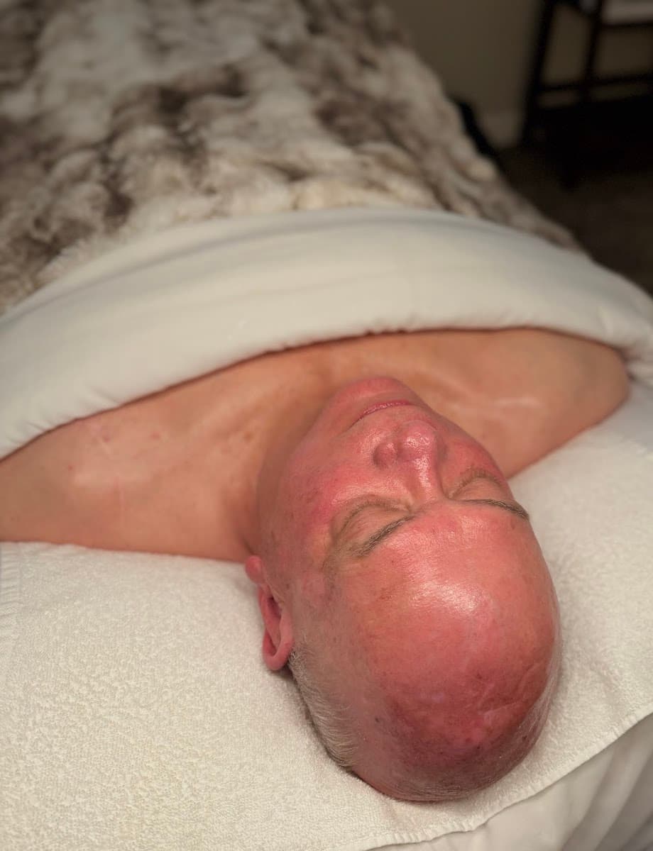 Simple Skin Utah photo 1 of 6