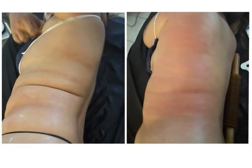 Skin Care and Body Sculpting