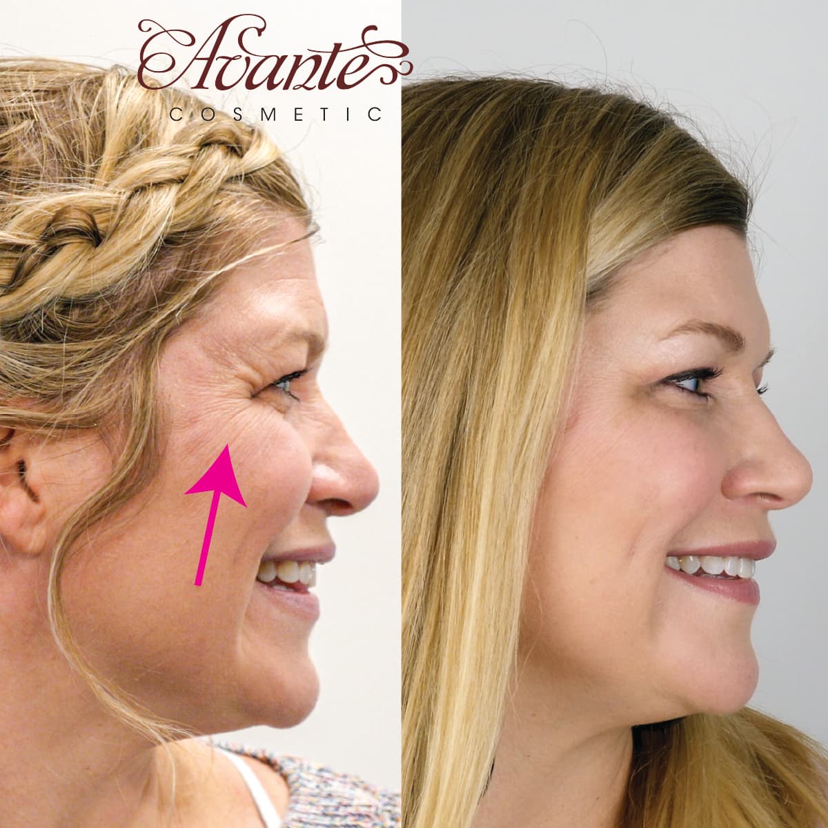 Avante Cosmetic