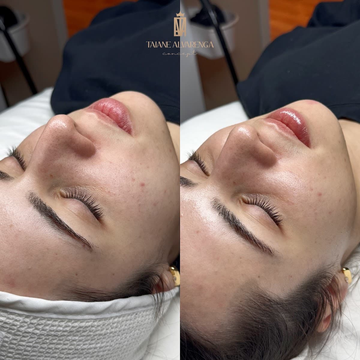 Taiane Alvarenga Concept Skin Clinic photo 1 of 8