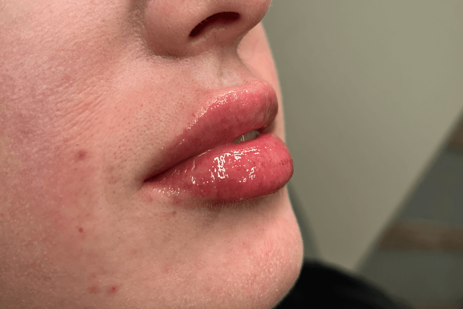 Lash and Company Med Spa - Rino photo 1 of 8