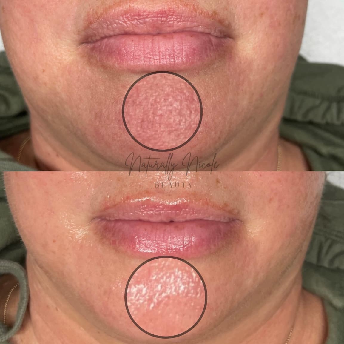Naturally Nicole Beauty Medical Aesthetics