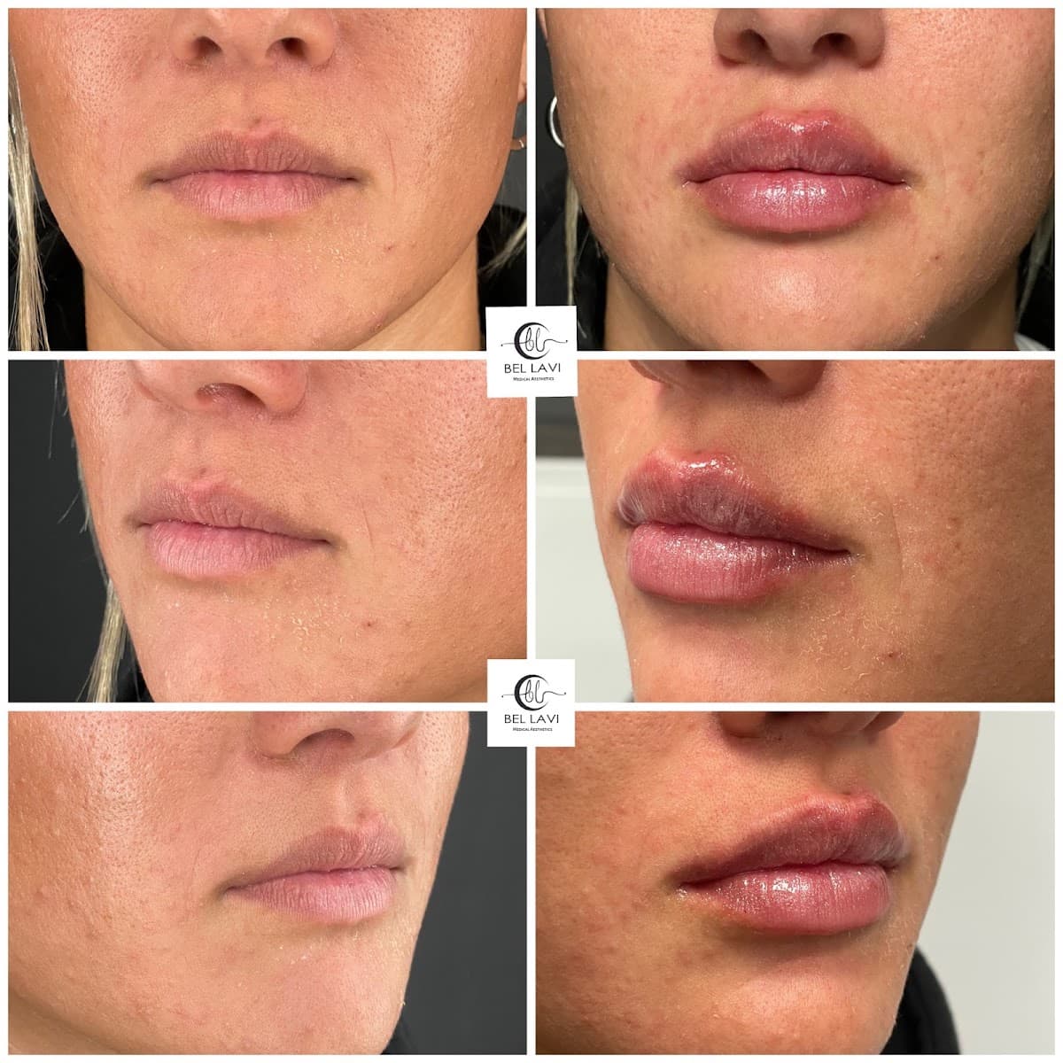 Bel Lavi Medical Aesthetics