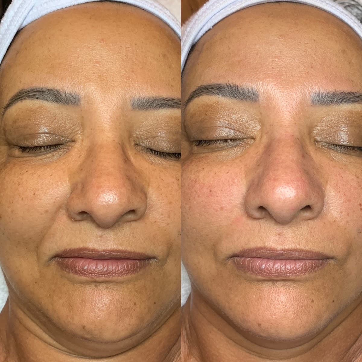 V Facial Beauty LLC