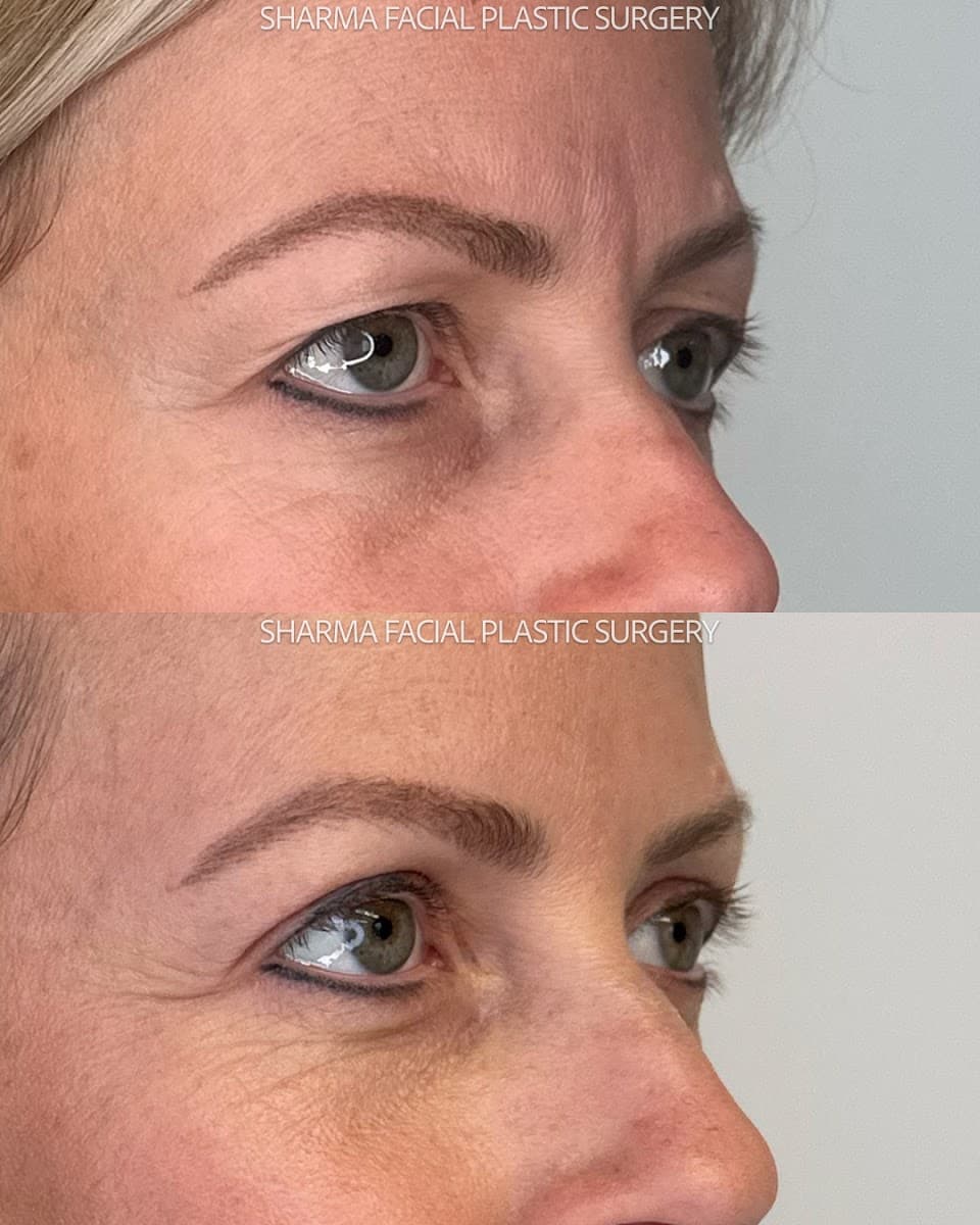 Giriraj K. Sharma, MD - Facial Plastic Surgery