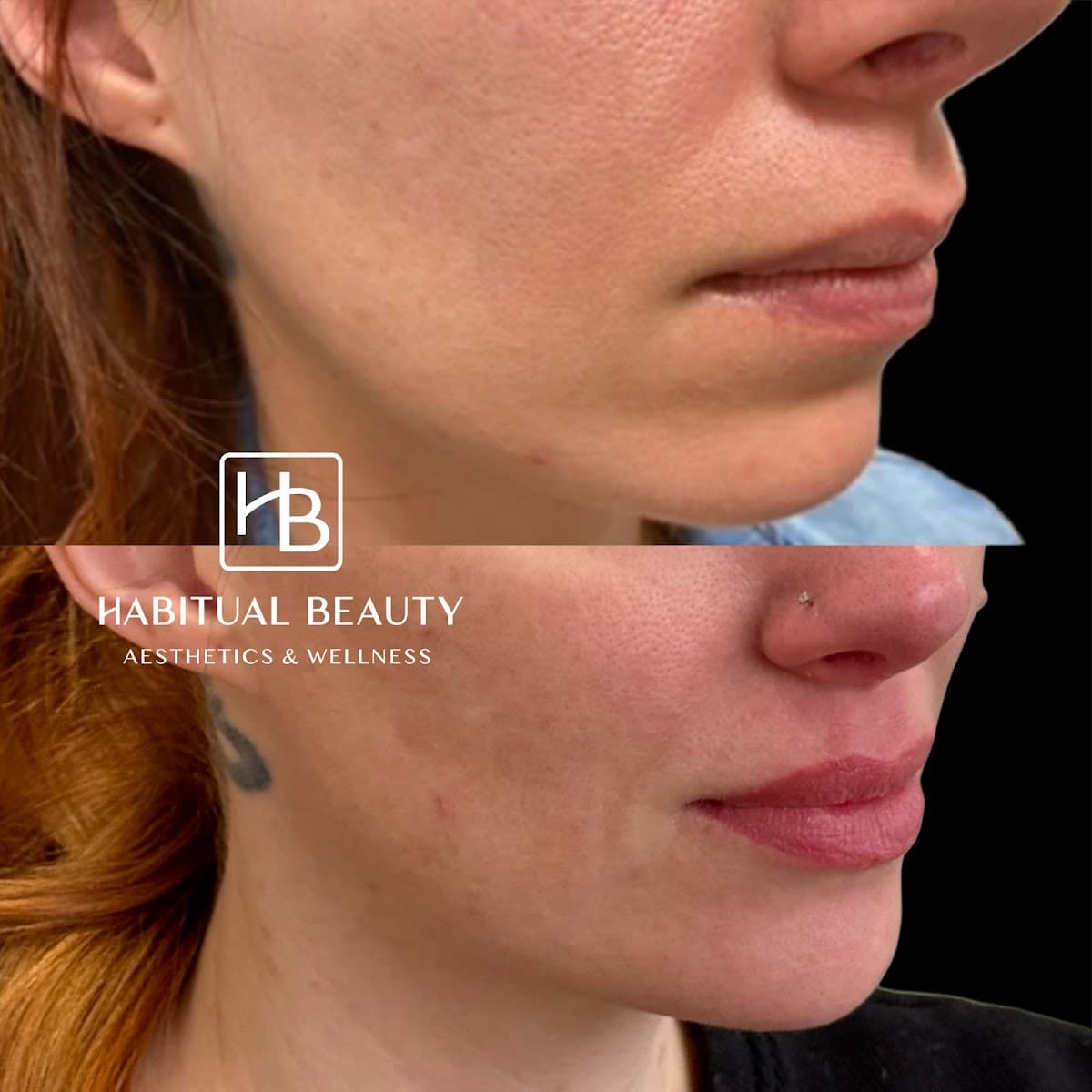 Habitual Beauty Aesthetics & Wellness