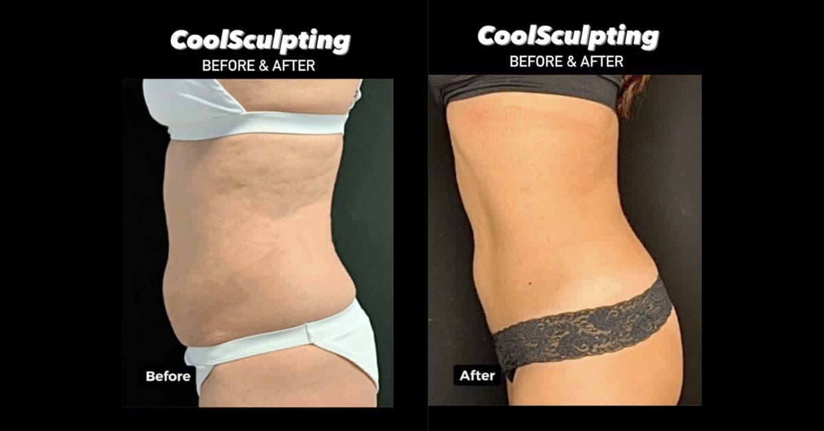 Young Medical Spa - Lansdale