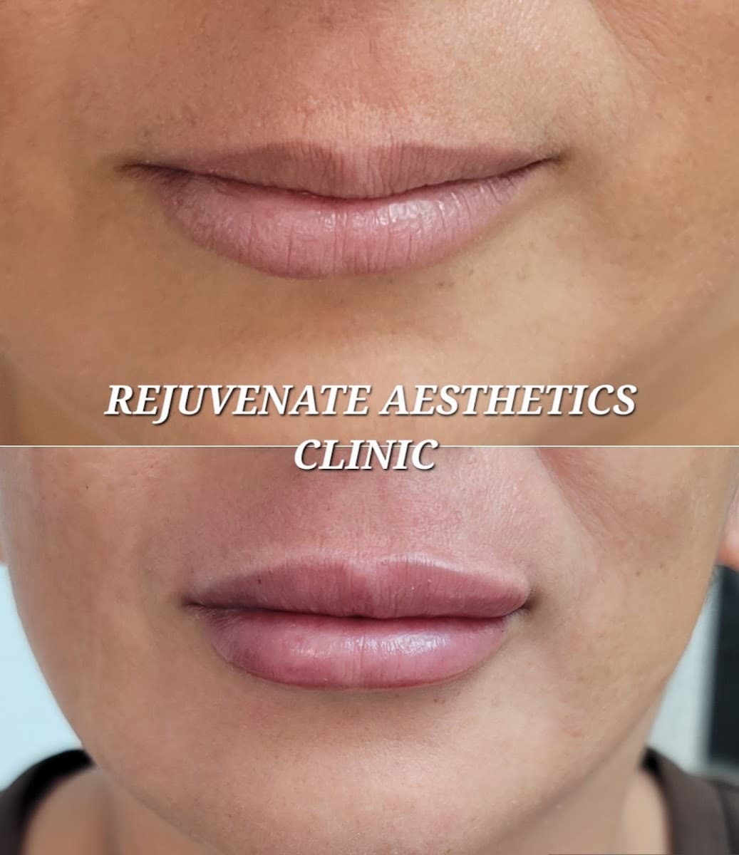 Rejuvenate Aesthetics Clinic photo 1 of 8