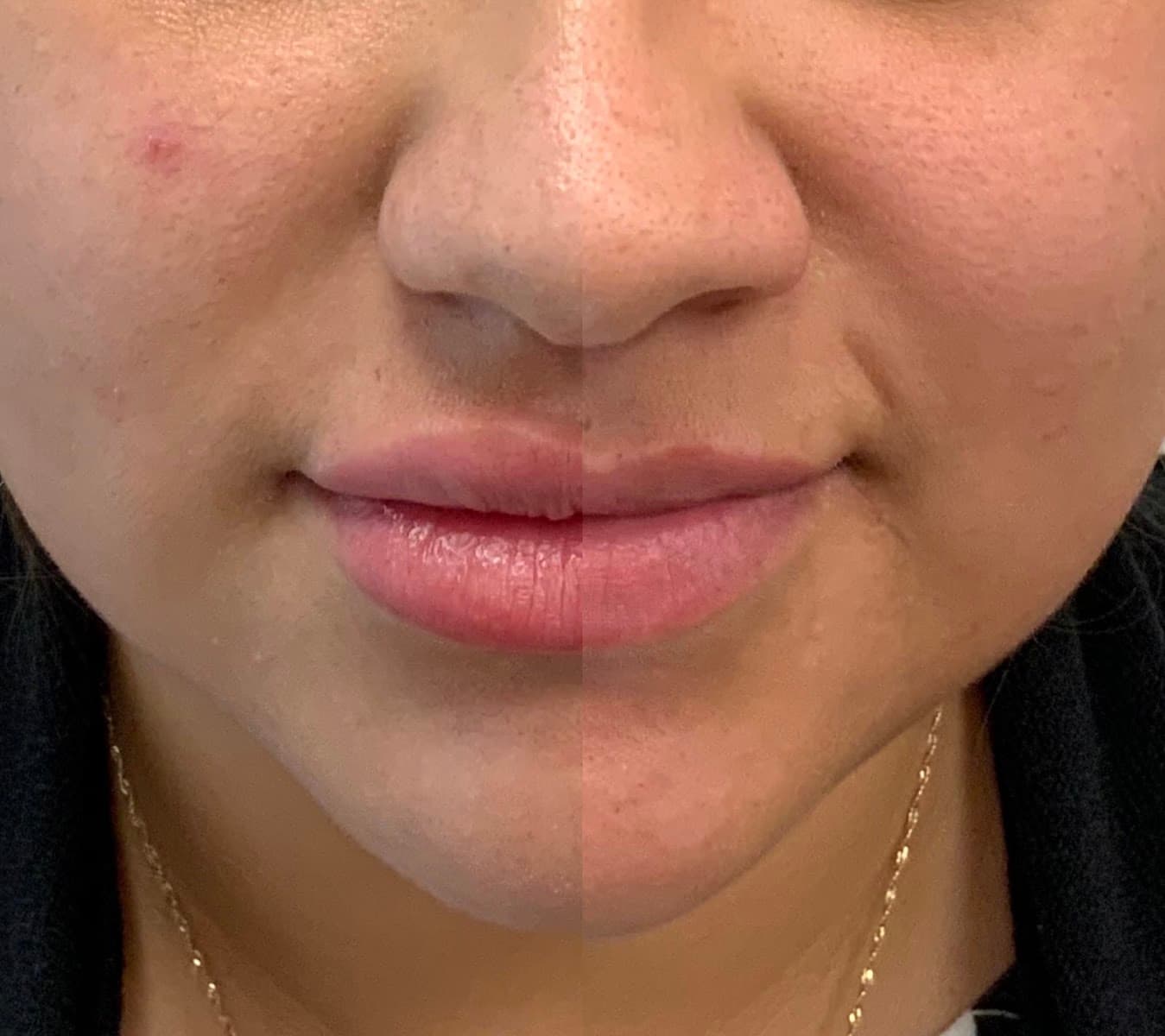 Aesthetics, by Dr. Lee