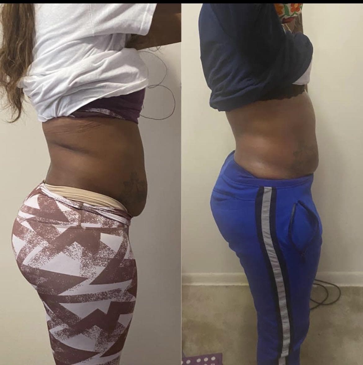 Skin laboratory | Facial & Body Sculpting