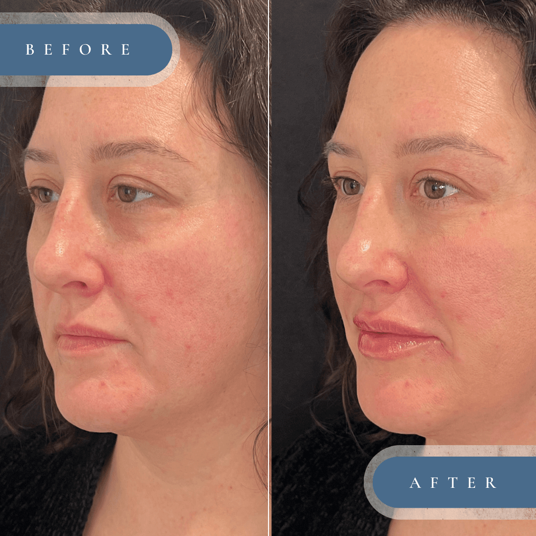 Dr Hillary Taggart (Modern SLC Injections & Aesthetics MedSpa)