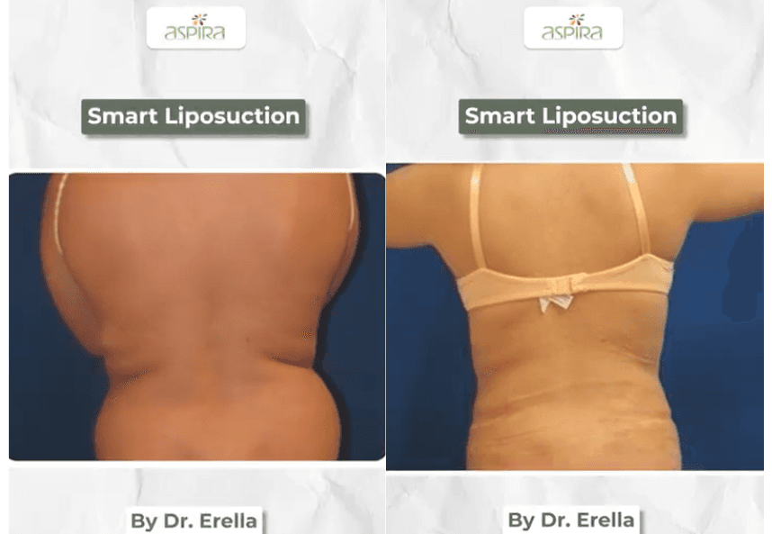 Aspira Plastic Surgery & Med Spa: Dr. Venkata Erella photo 1 of 8