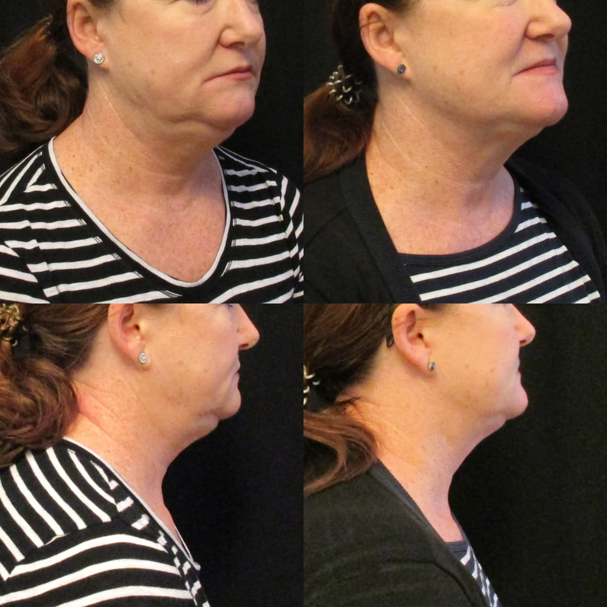 Medical Spa NW