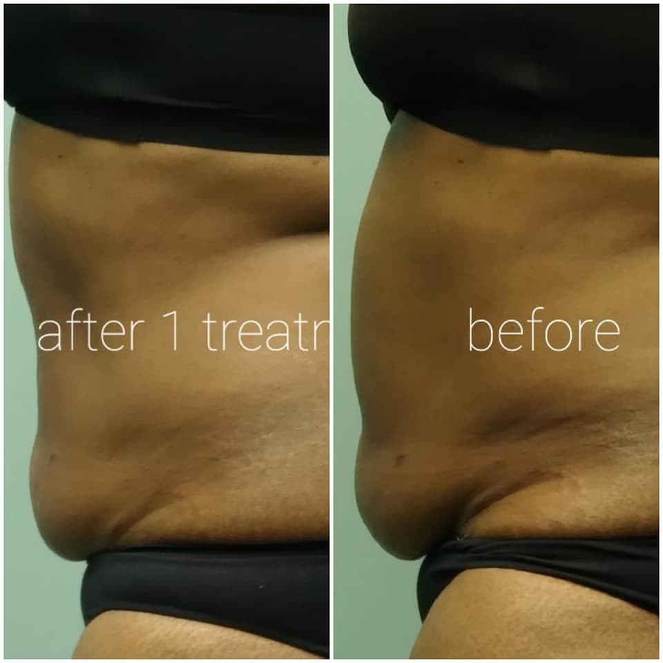Amani Adore Cryo Spa