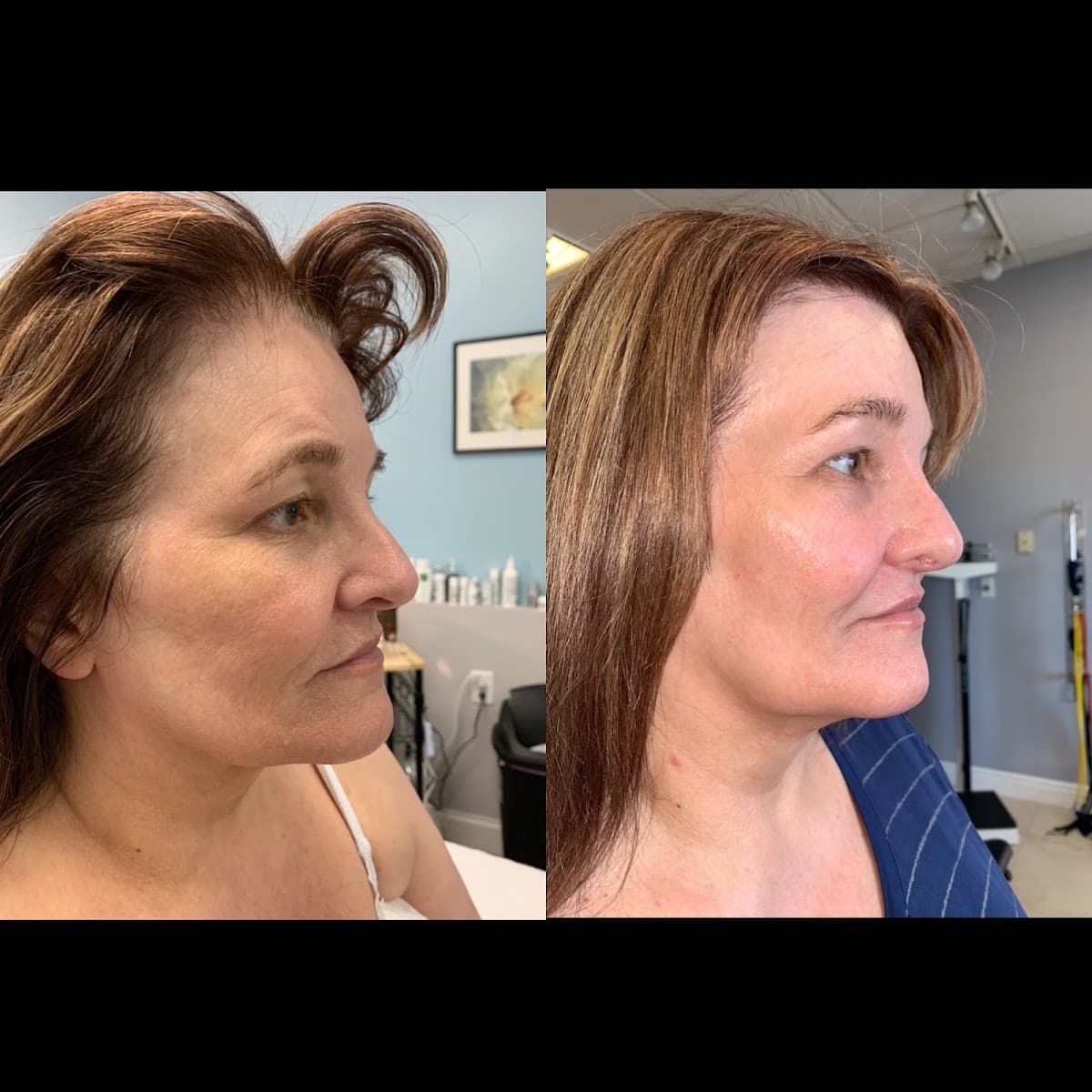 Efflorescence Aesthetic and Cellulite Reduction Spa
