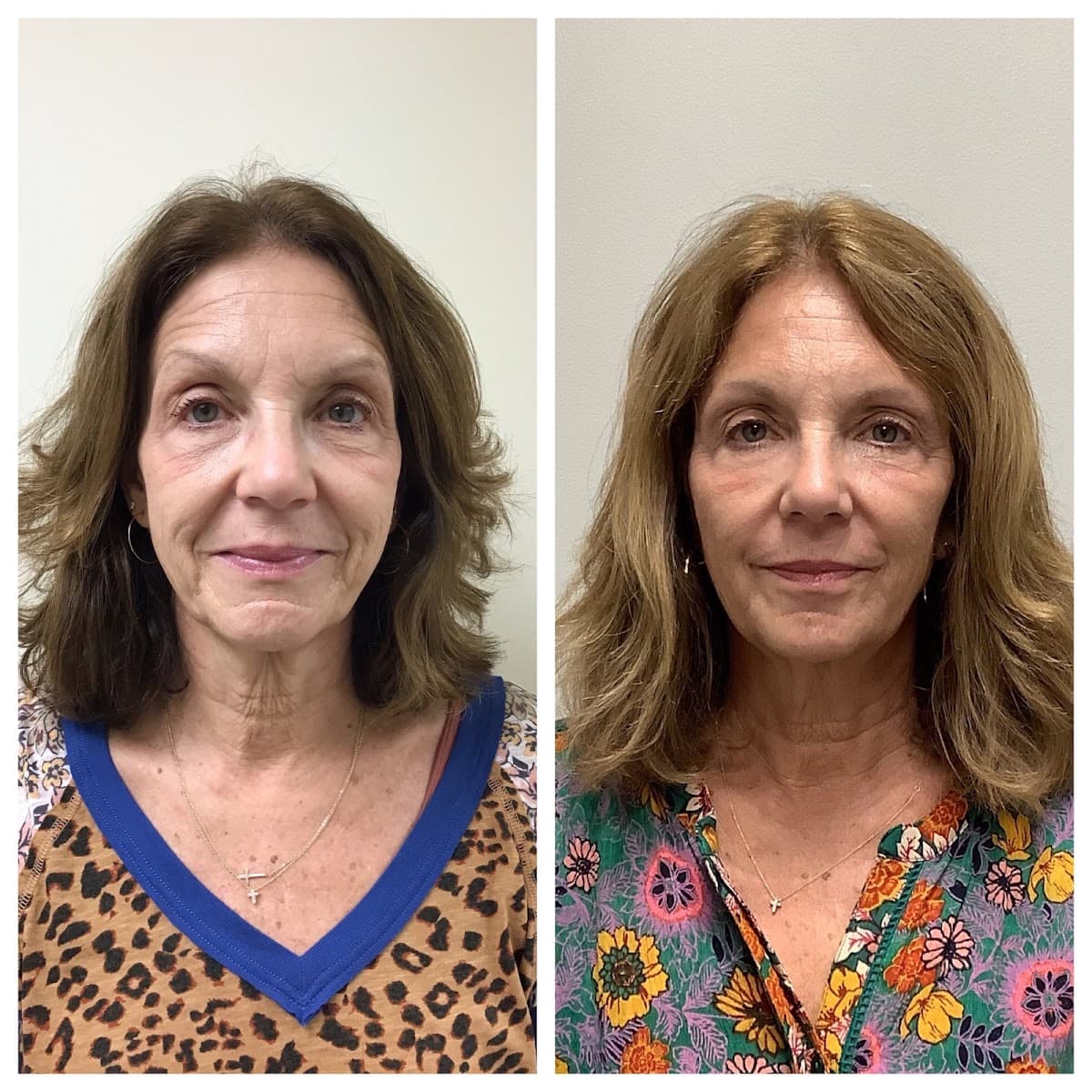 Hush Medical Aesthetics photo 1 of 8