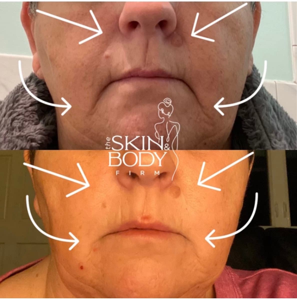 The Skin and Body Firm