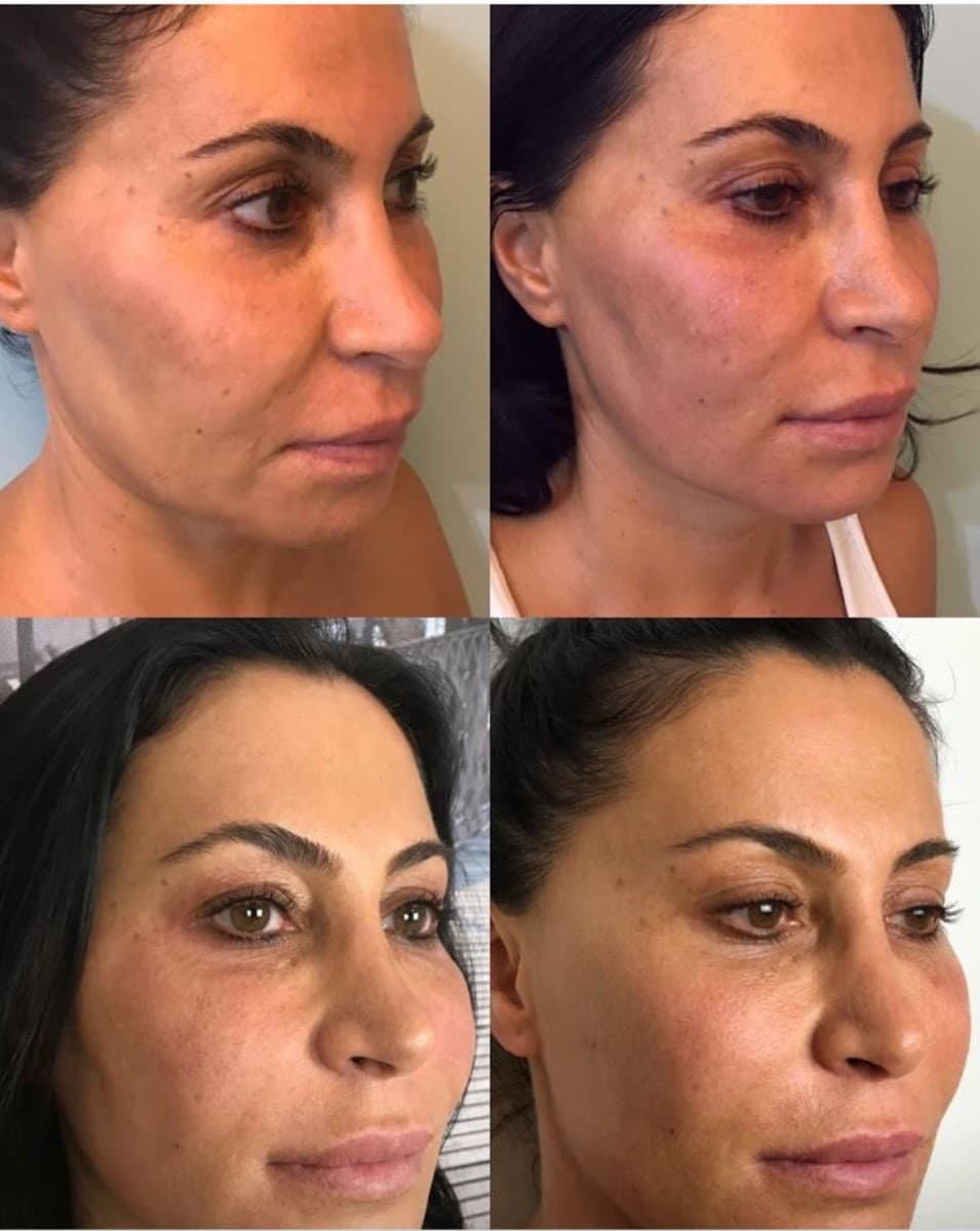 Lymface ( former Facegym Miami ) photo 1 of 8